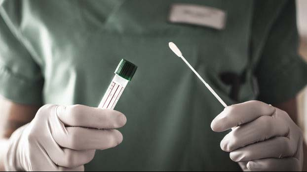 Test de antígenos | Diariofarma